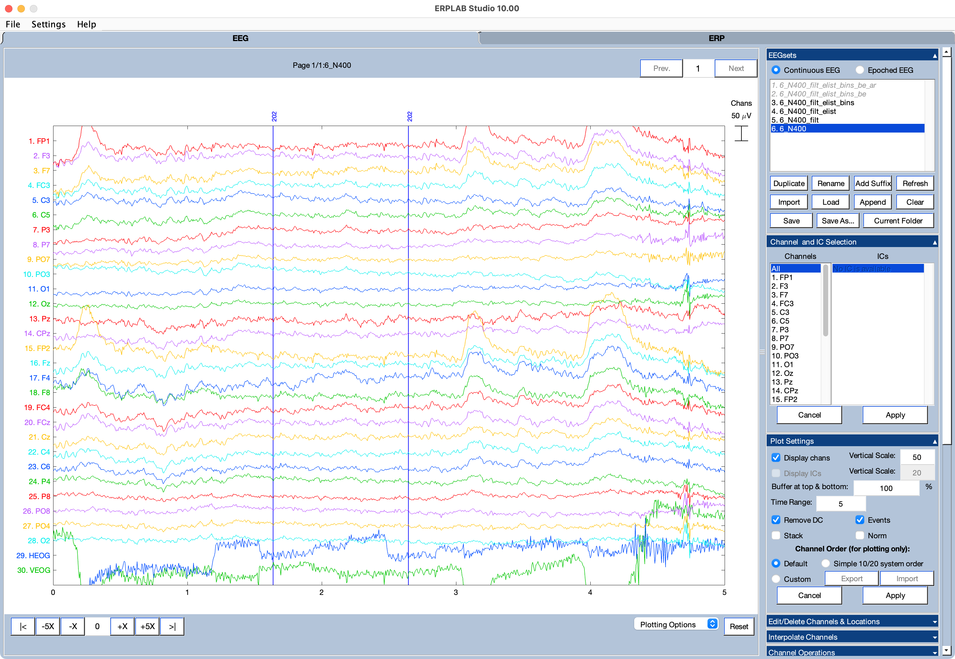 EEG Tab Example